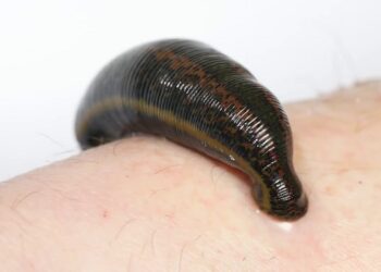 mo-thay-dia-can-danh-con-gi-chuan